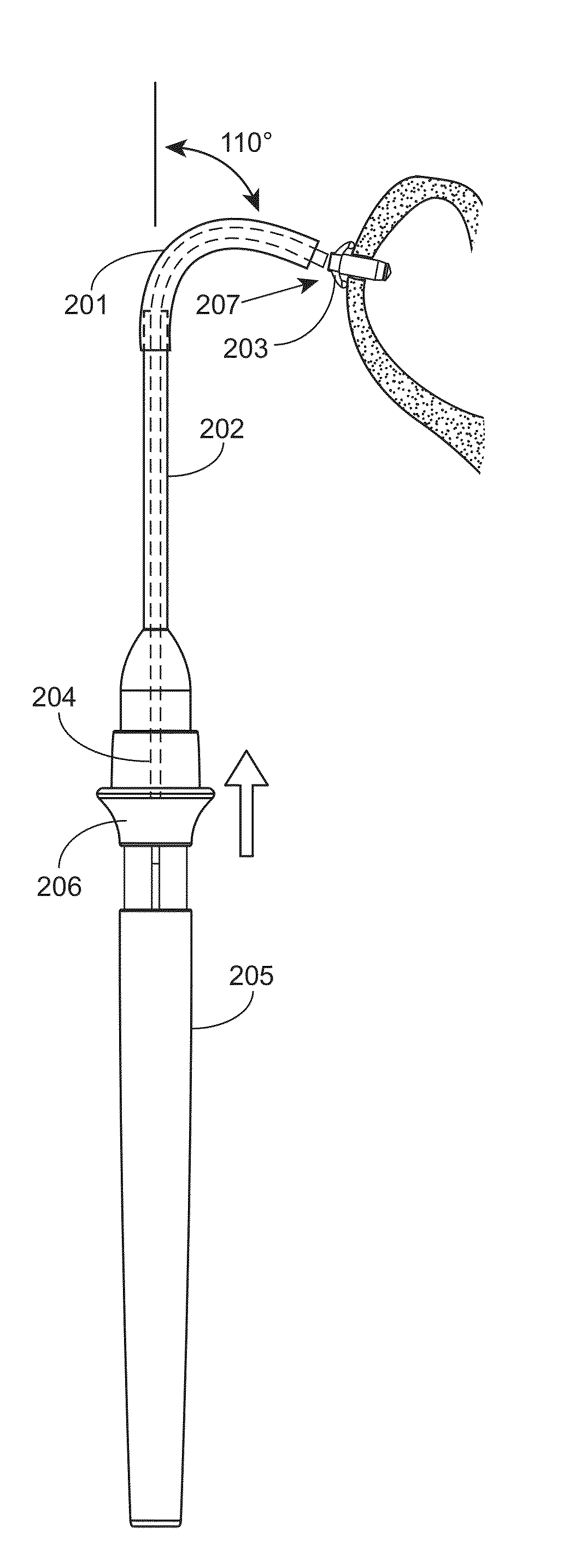 Devices and methods for inserting a sinus dilator