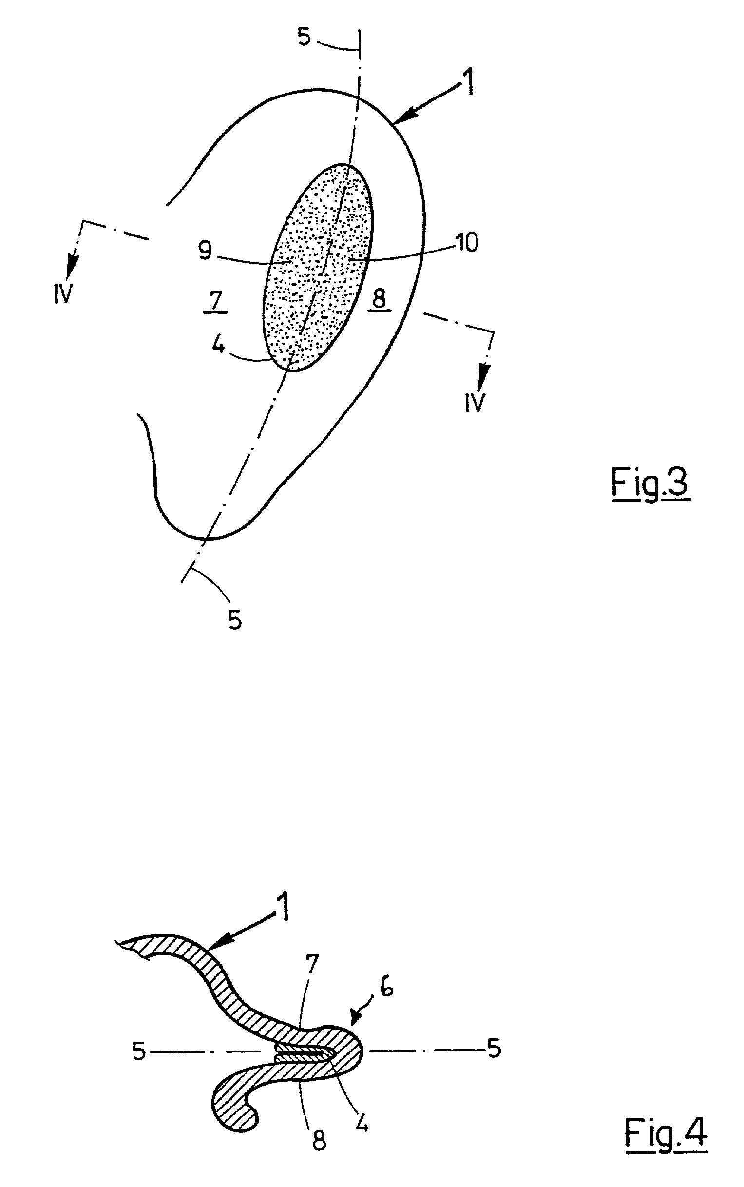Device for non-invasively correcting the shape of a human external ear