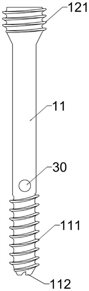 Guiding hollow screw with implantable filler