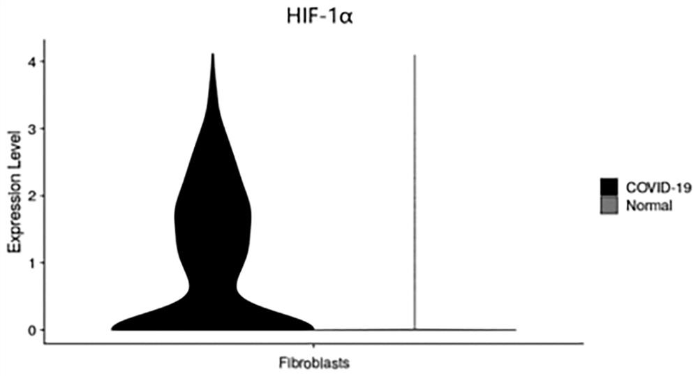 Application of AR inhibitor and/or HIF-1[alpha] inhibitor in preparation of medicine