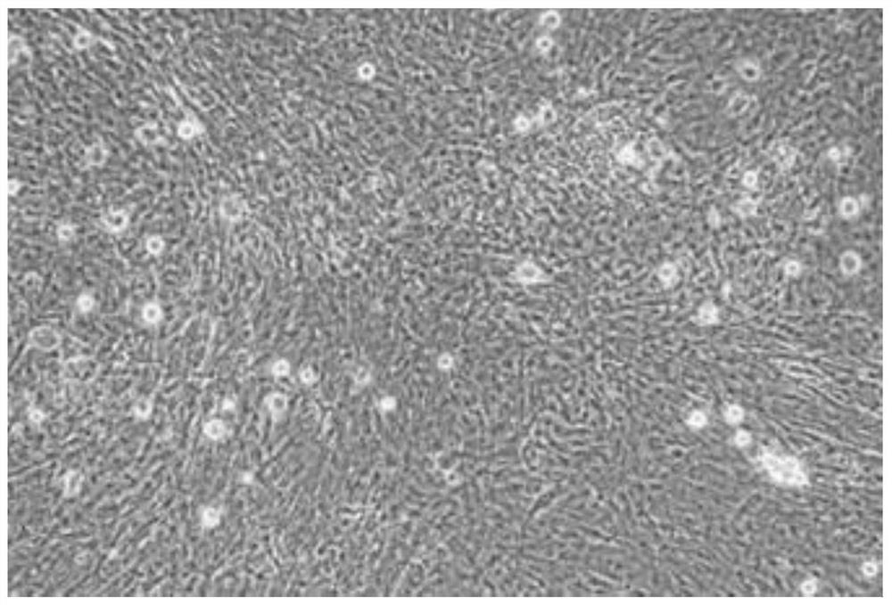 Method for separating and culturing mouse small intestine organoid capable of peristalsis in vitro