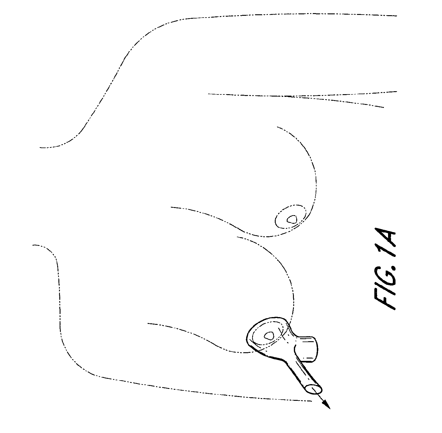 Device for determining risk of developing breast cancer and method thereof