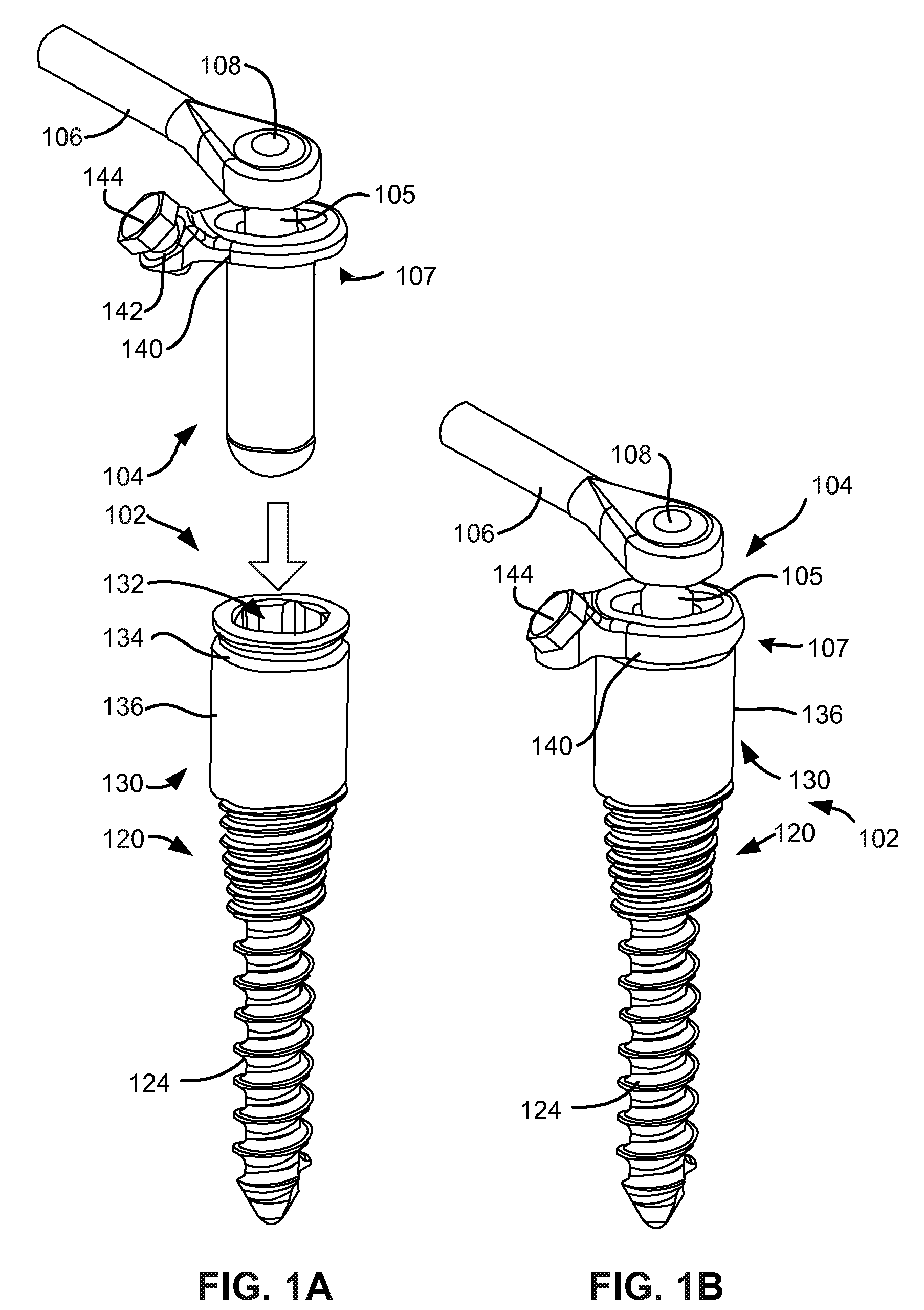 Load-sharing bone anchor having a deflectable post and method for stabilization of the spine