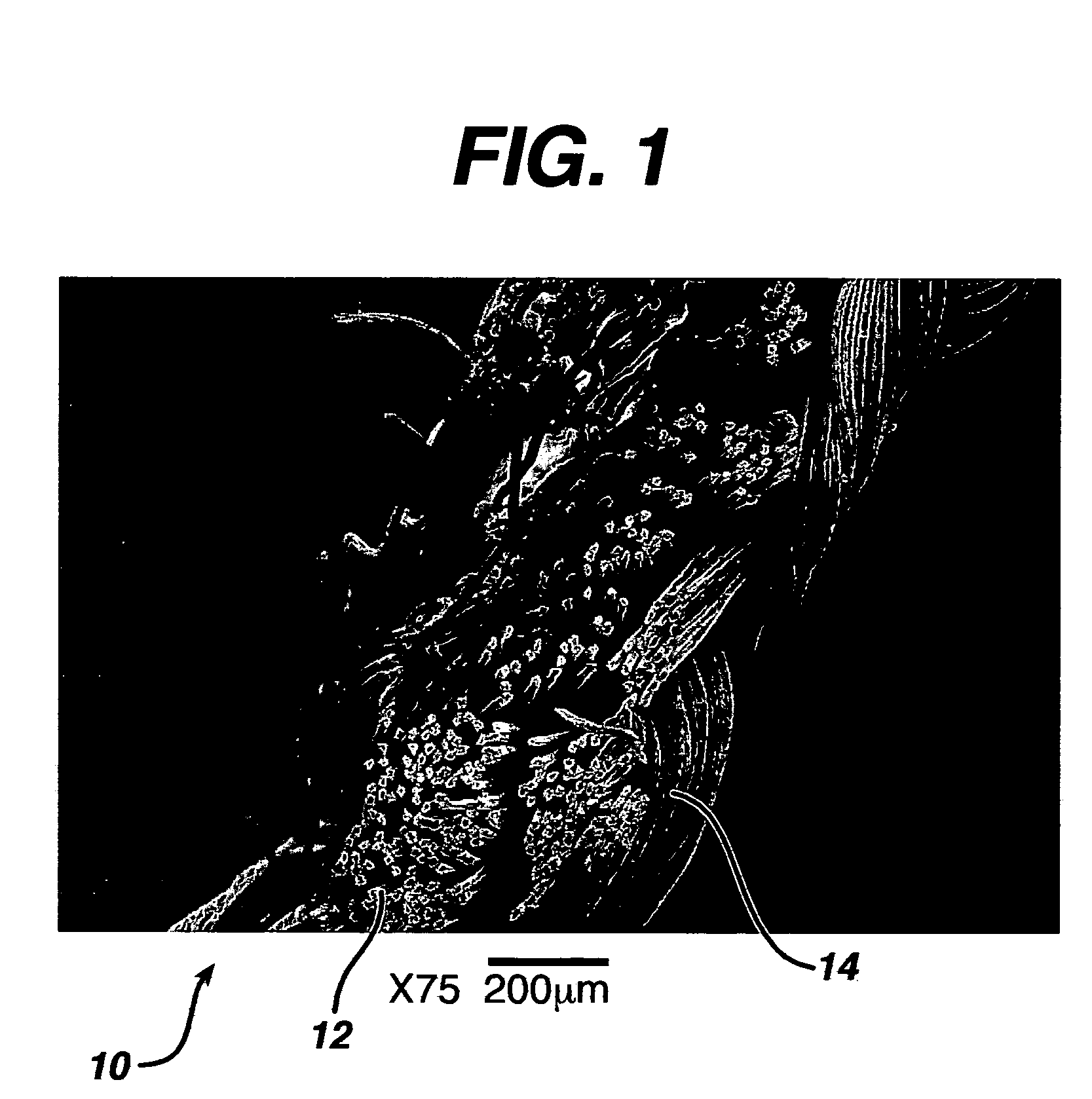 Hemostatic wound dressings and methods of making same
