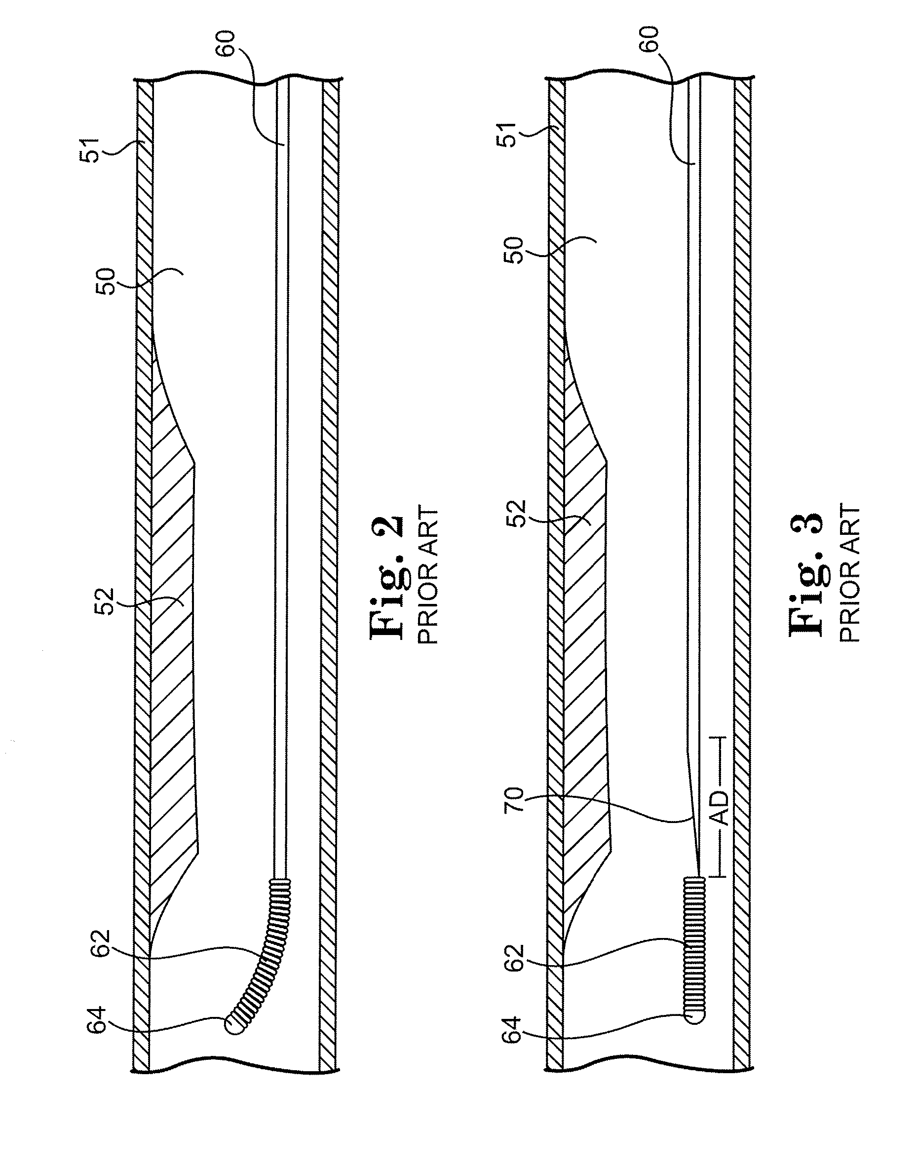 System, apparatus and method for opening an occluded lesion