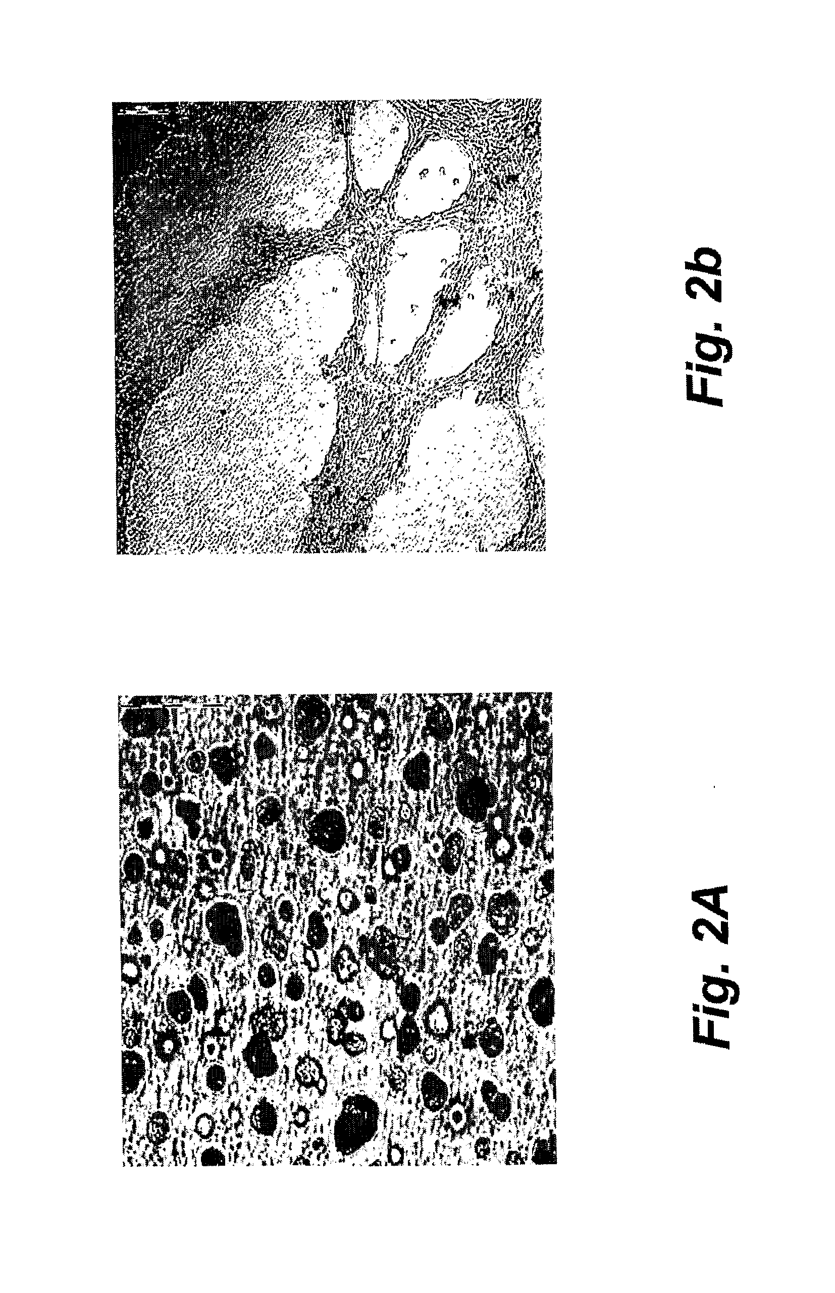 Method and means for culturing osteoblastic cells