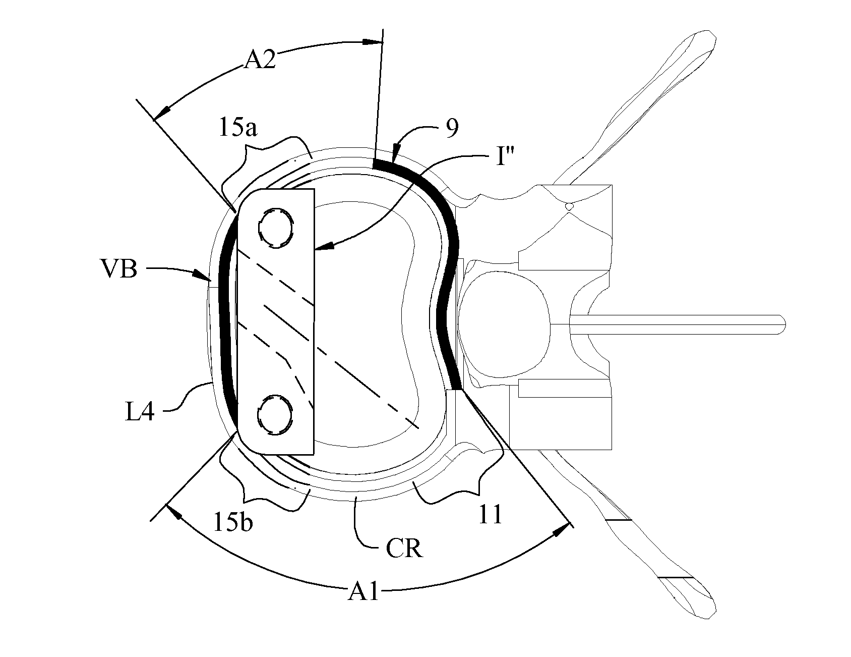 Expandable interbody implant and method