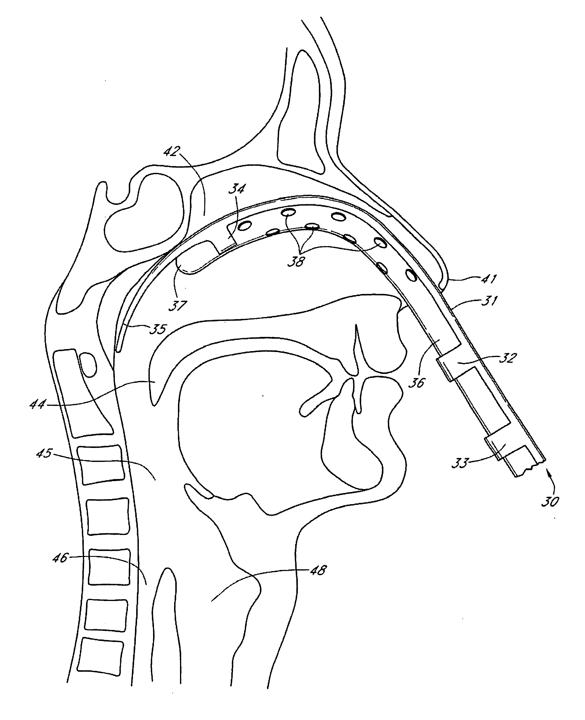 Intubation devices and methods of use thereof