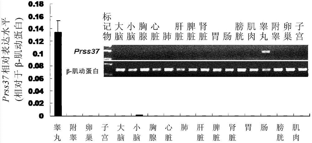 Animal model with male reproductive disorders, as well as preparation method and application thereof