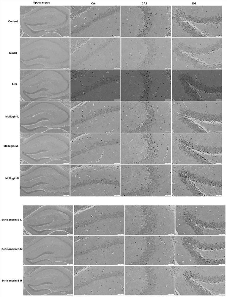 Application of GLP-1R micromolecule agonist in diabetes and related complications and medicine