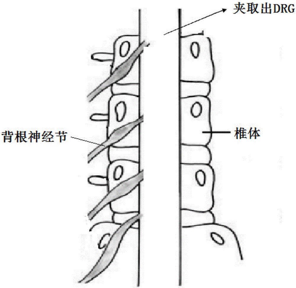 Primary culturing method for dorsal root ganglion satellite glial cells