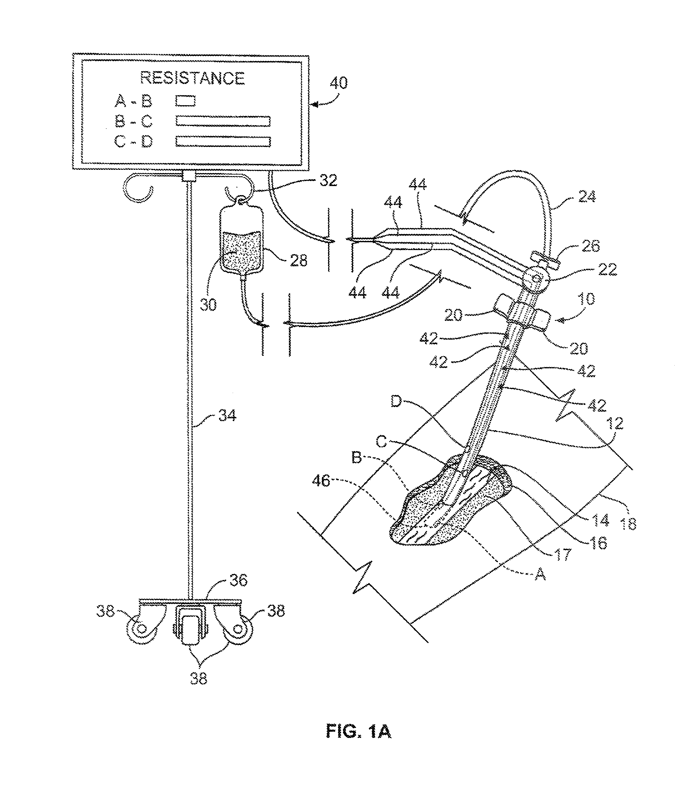 Apparatus and method for monitoring catheter insertion