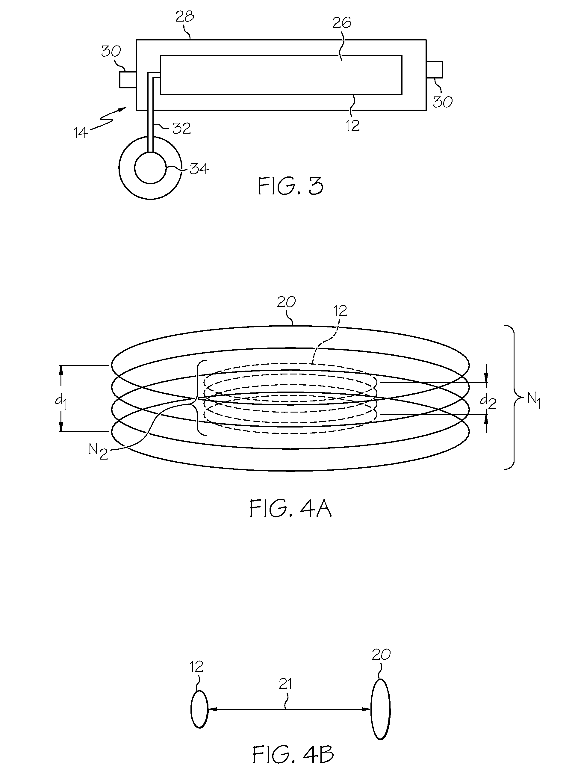 Device for Monitoring Size of Luminal Cavity