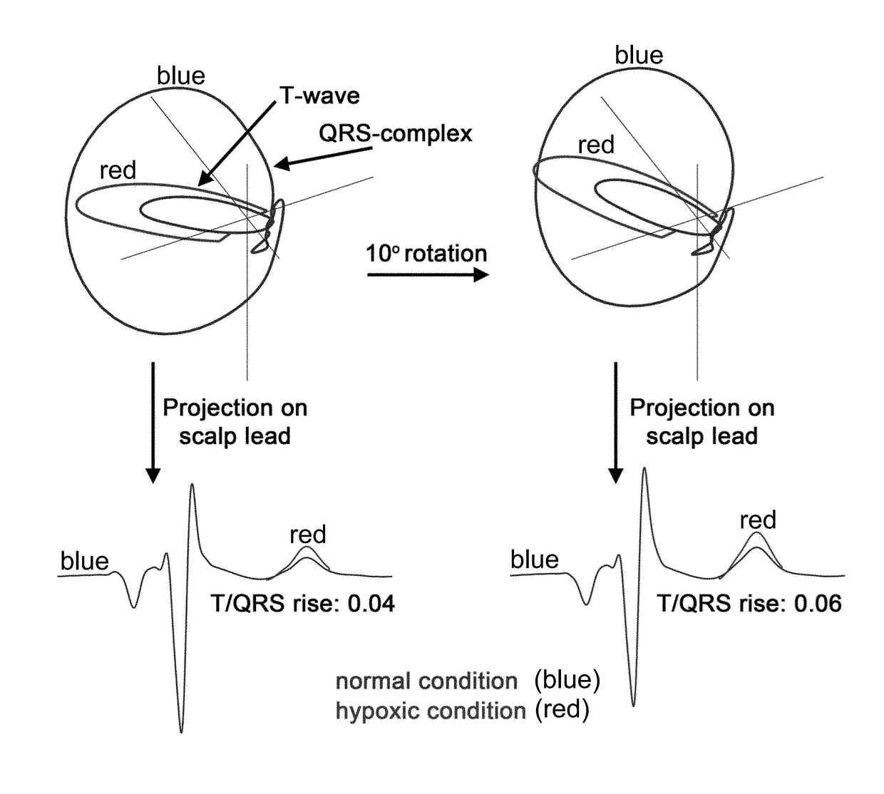 Fetal cardiotocography monitoring