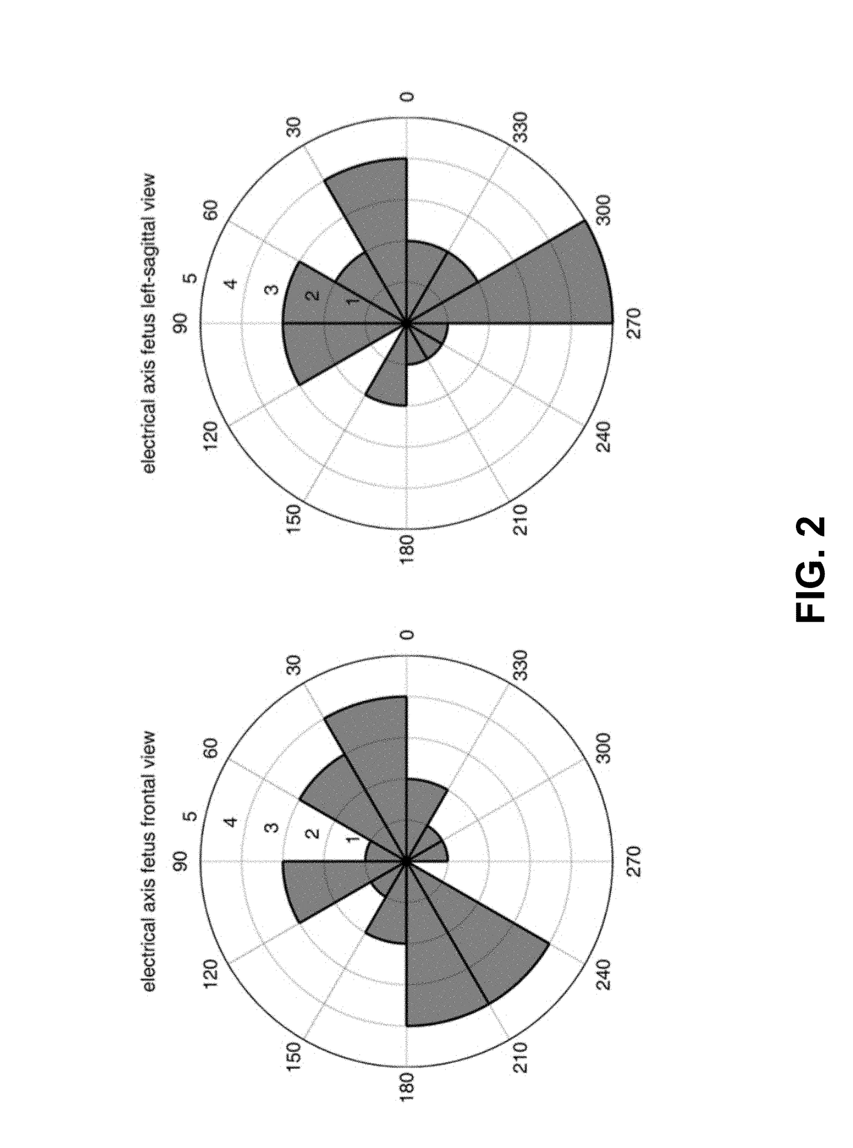 Fetal cardiotocography monitoring