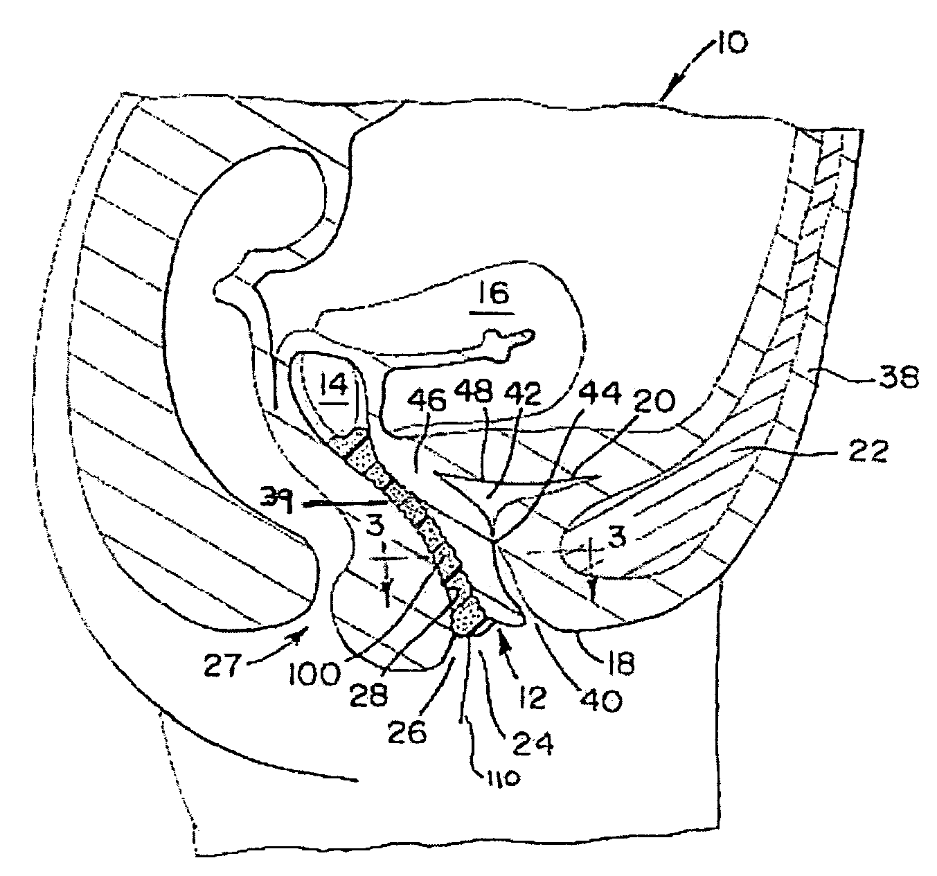 Anatomically conforming vaginal insert
