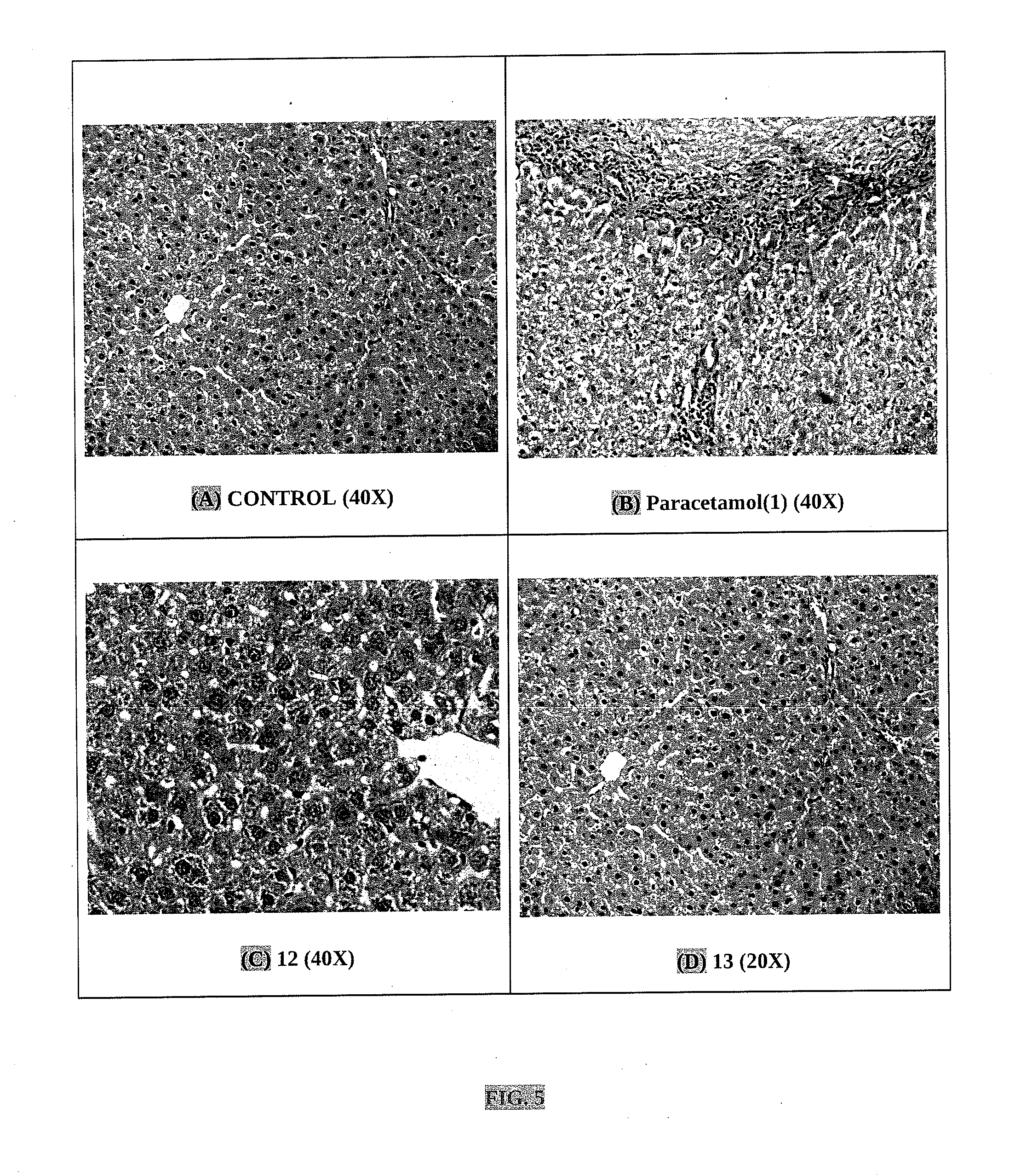 Nitric oxide releasing derivatives of paracetamol