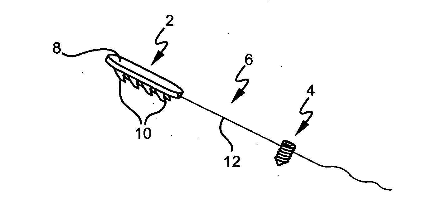 Device for attaching, relocating and reinforcing tissue and methods of using same