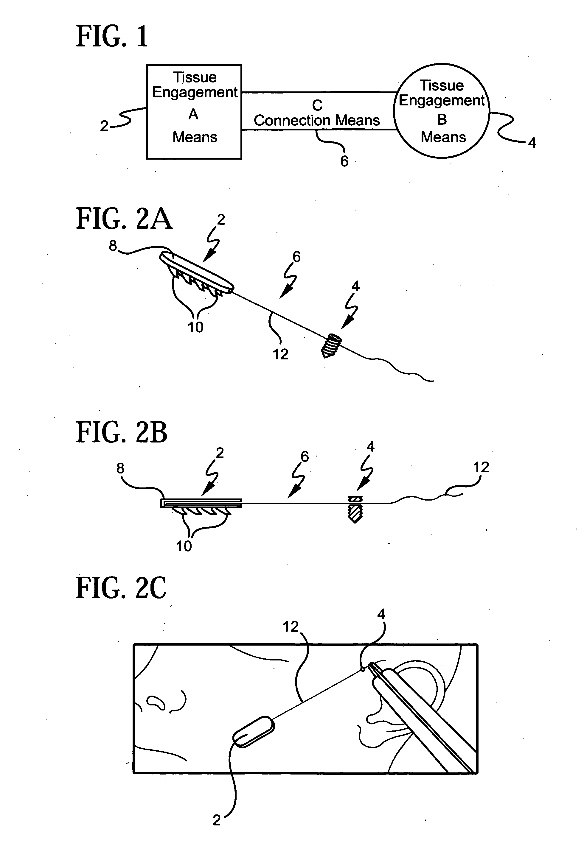 Device for attaching, relocating and reinforcing tissue and methods of using same