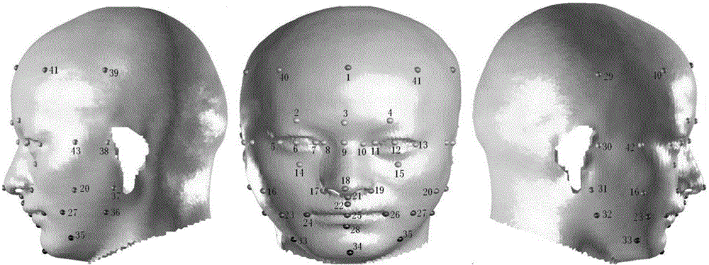 Model library for craniofacial restoration and craniofacial restoration method