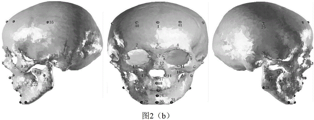 Model library for craniofacial restoration and craniofacial restoration method