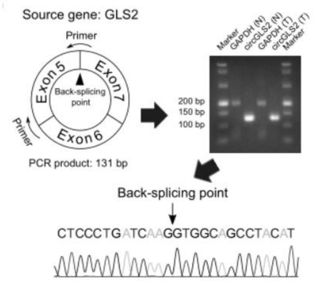 CircGLS2 and application thereof in diagnosis, treatment and prognosis of liver cancer