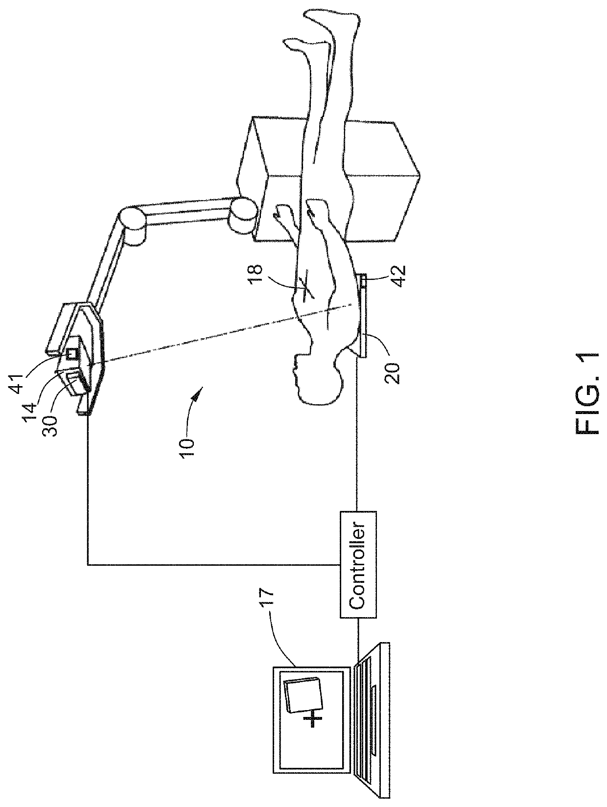 Mobile radiography system and method for aligning mobile radiography system