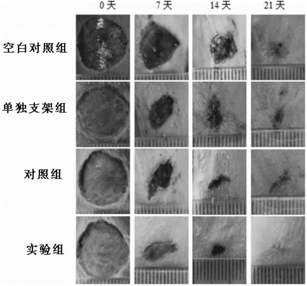 Composite Tbeta4 collagen-chitosan tissue engineering scaffold as well as preparation method and application thereof