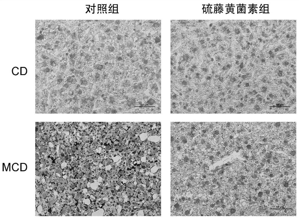 Application of thiolutin in the protection of nonalcoholic steatohepatitis