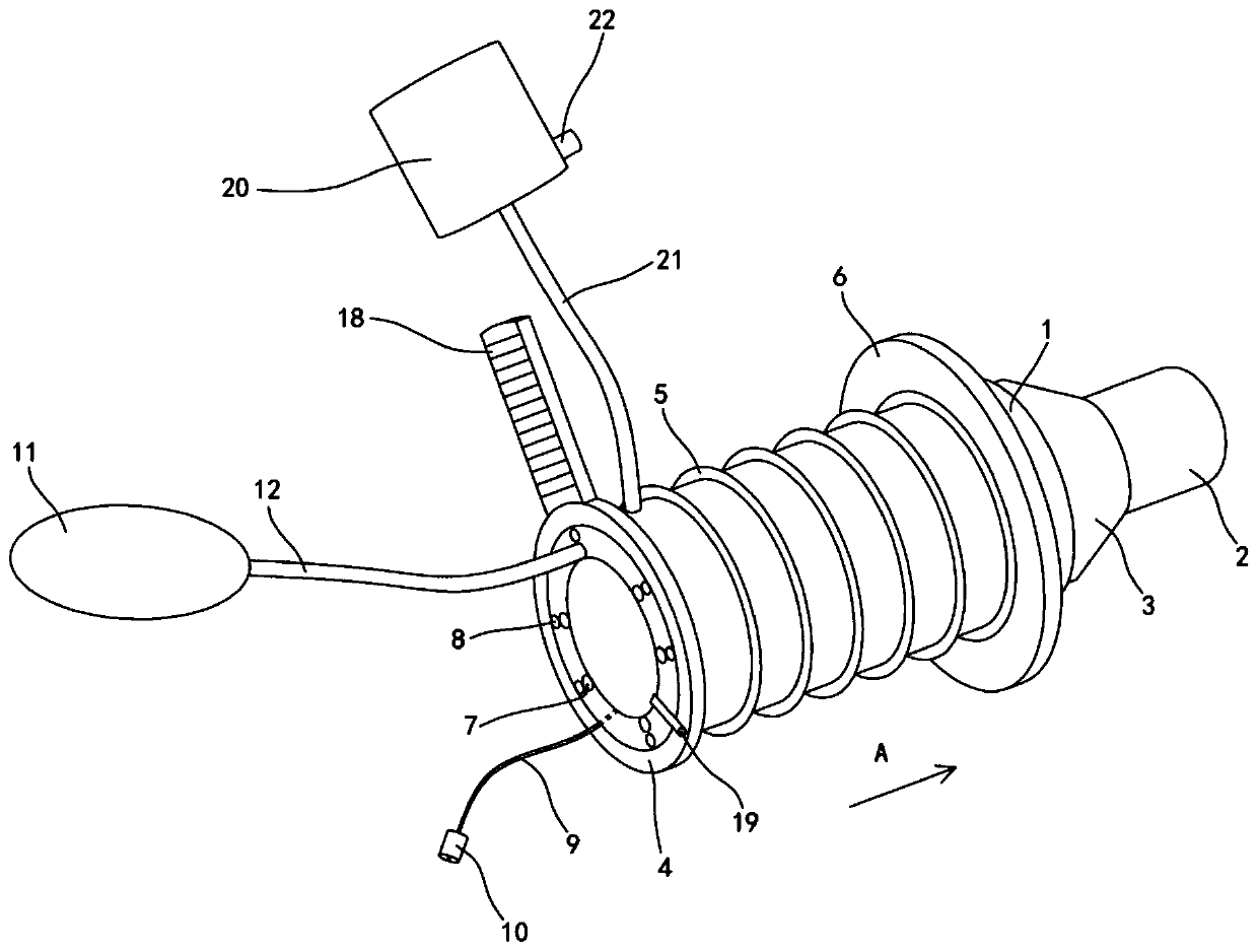 Anoscope and using method thereof