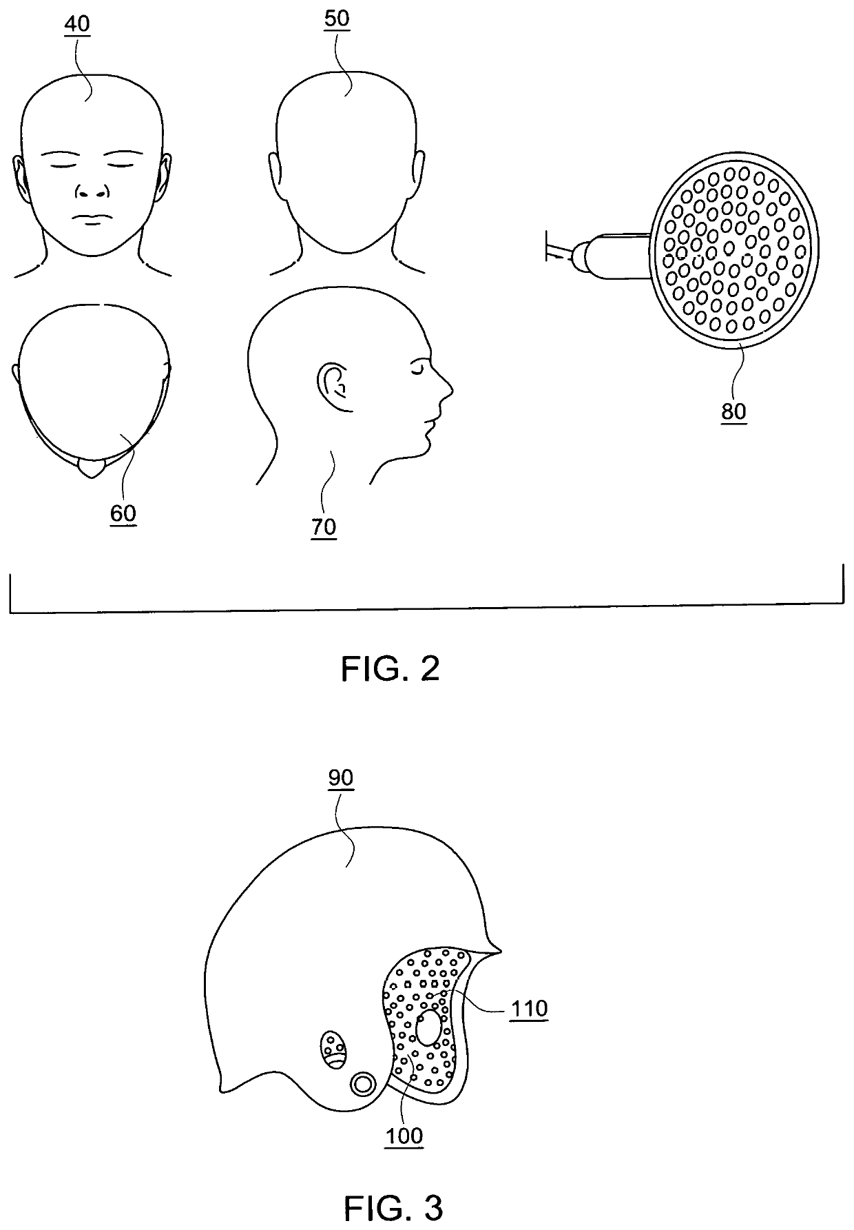 System and methods for treating brain related conditions with photobiomodulation therapy