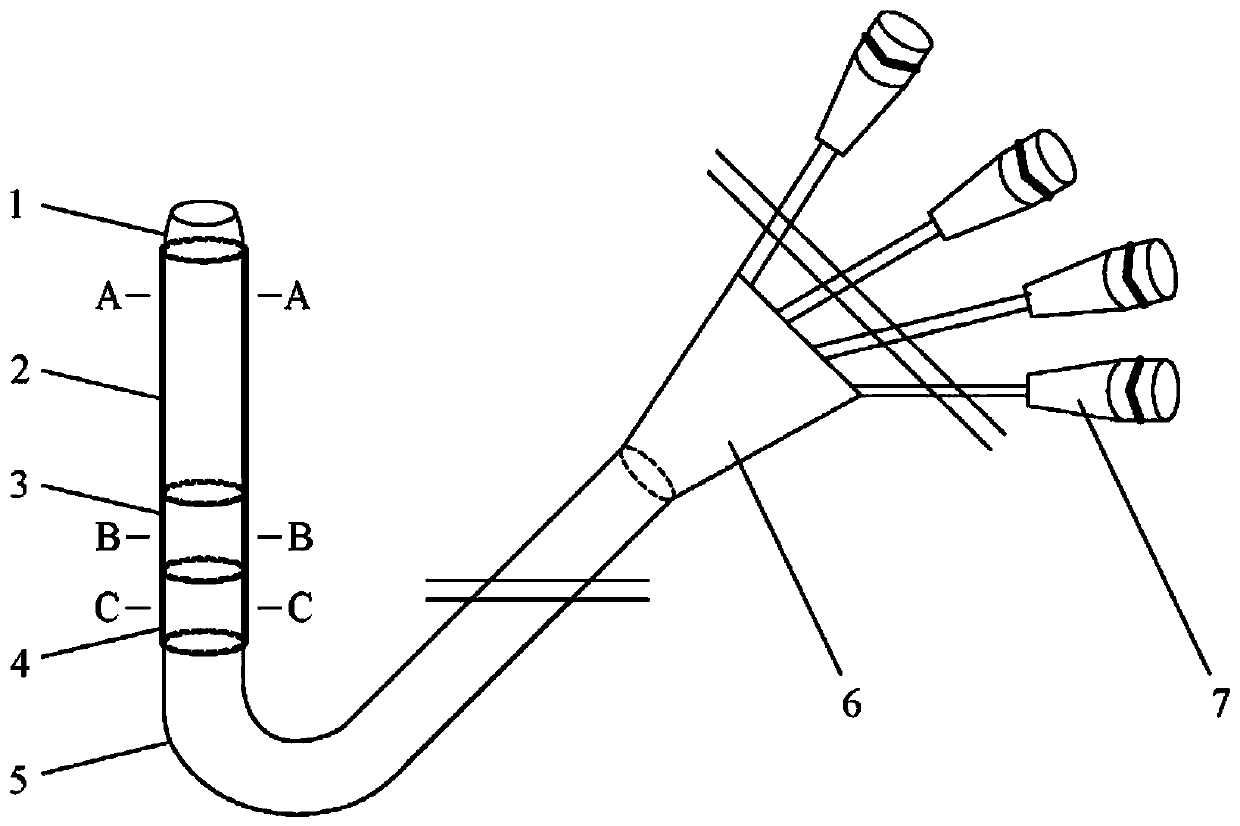 Multi-stage duodenal papilla dilation balloon catheter