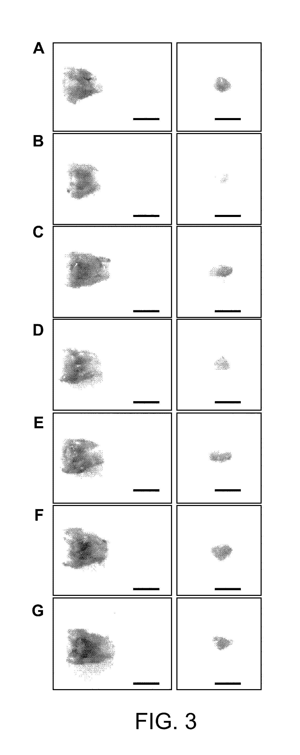 Pharmaceutical composition for preventing or treating thyroid diseases, comprising extract from <i>Lonicera caerulea </i>L. var. edulis fruits as active ingredient