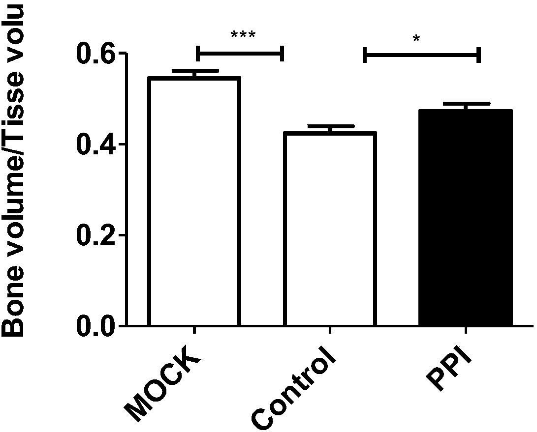 Small molecule compound for treating rheumatoid arthritis and application of small molecule compound