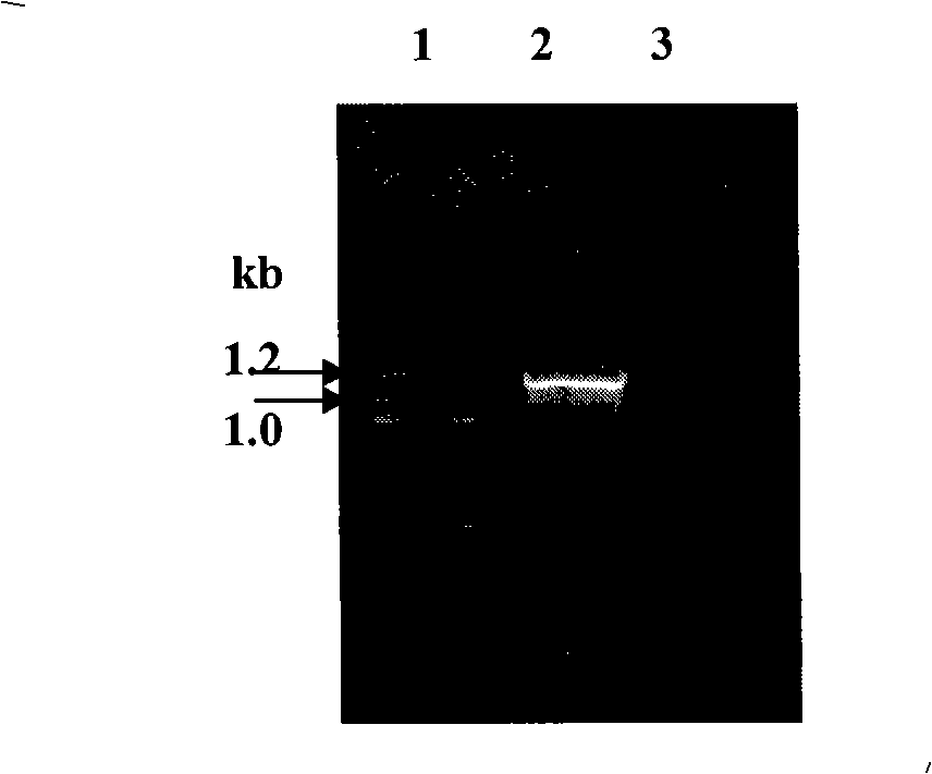 Recombinant clostridium and construction method and use thereof