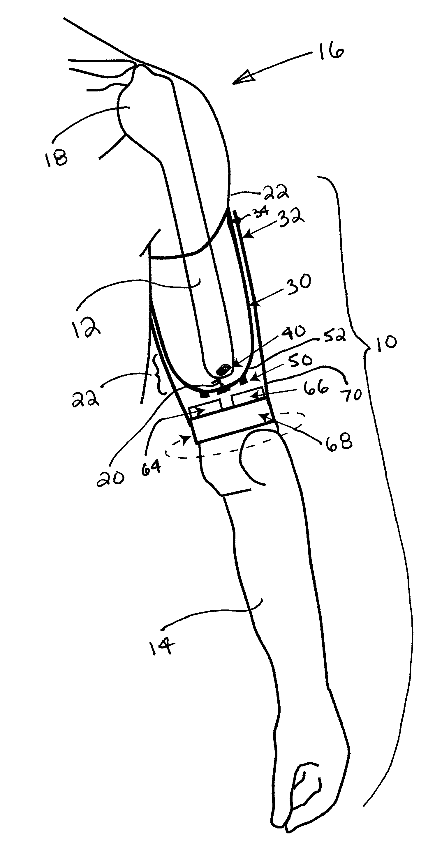 Method and apparatus for prosthetic limb rotation control