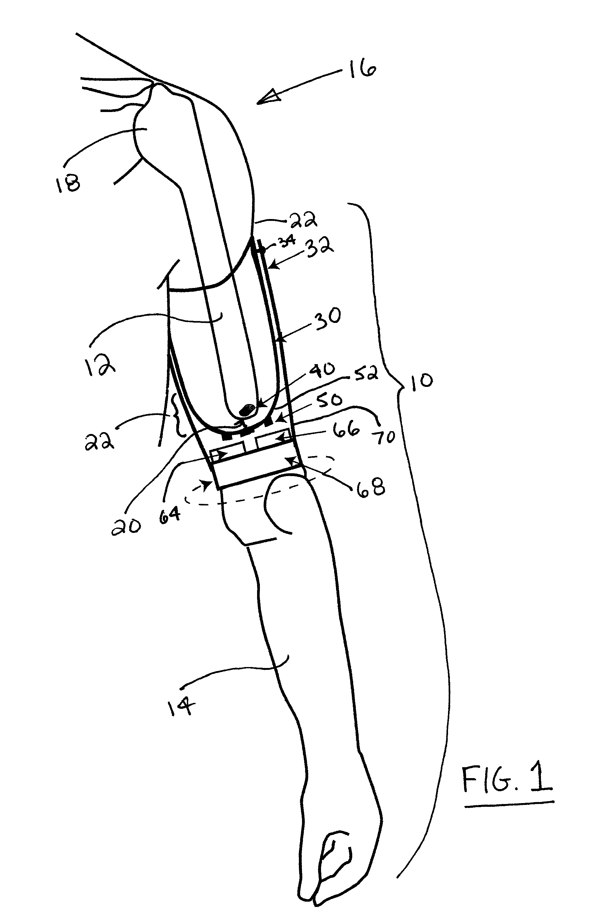 Method and apparatus for prosthetic limb rotation control