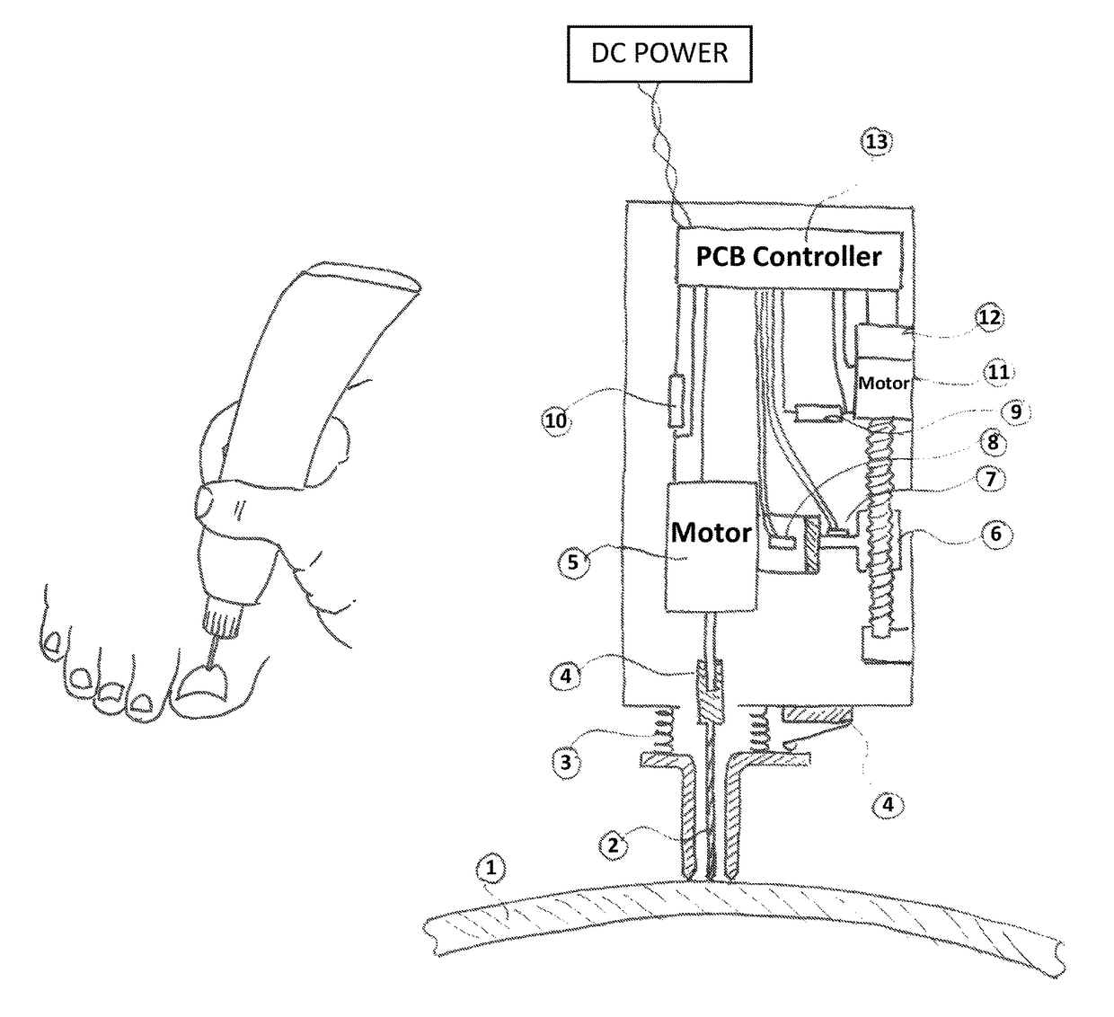 Medical device for controlled nail penetration