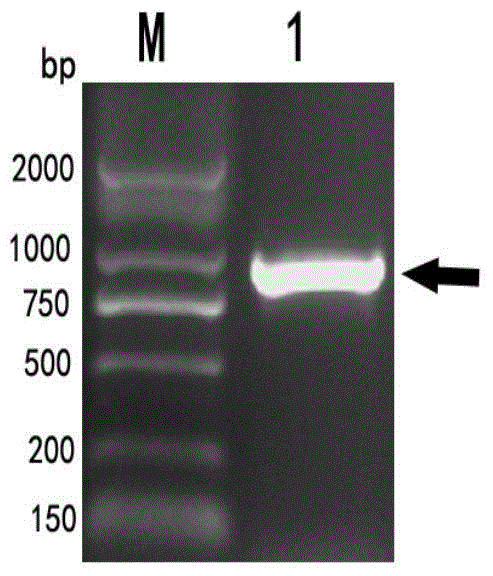 Riemerella anatipestifer surface antigen d15 truncated recombinant protein and its preparation method and application