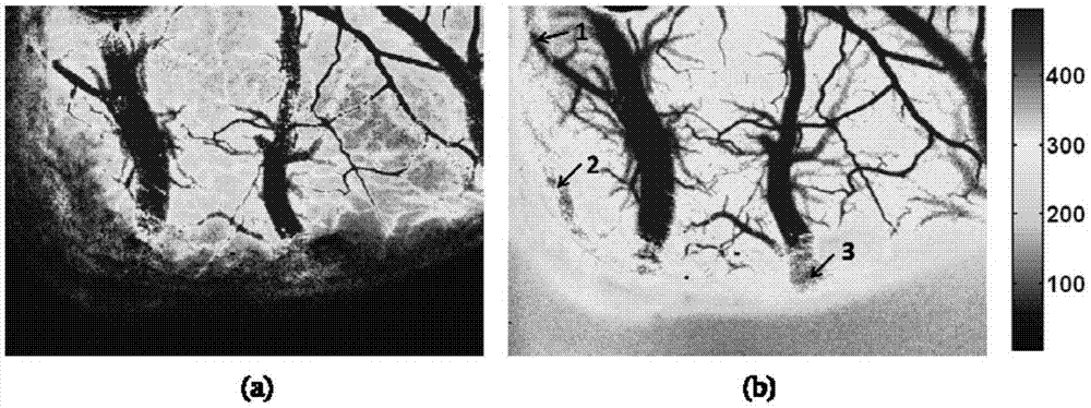 Scanning dark field laser speckle blood flow imaging method and device