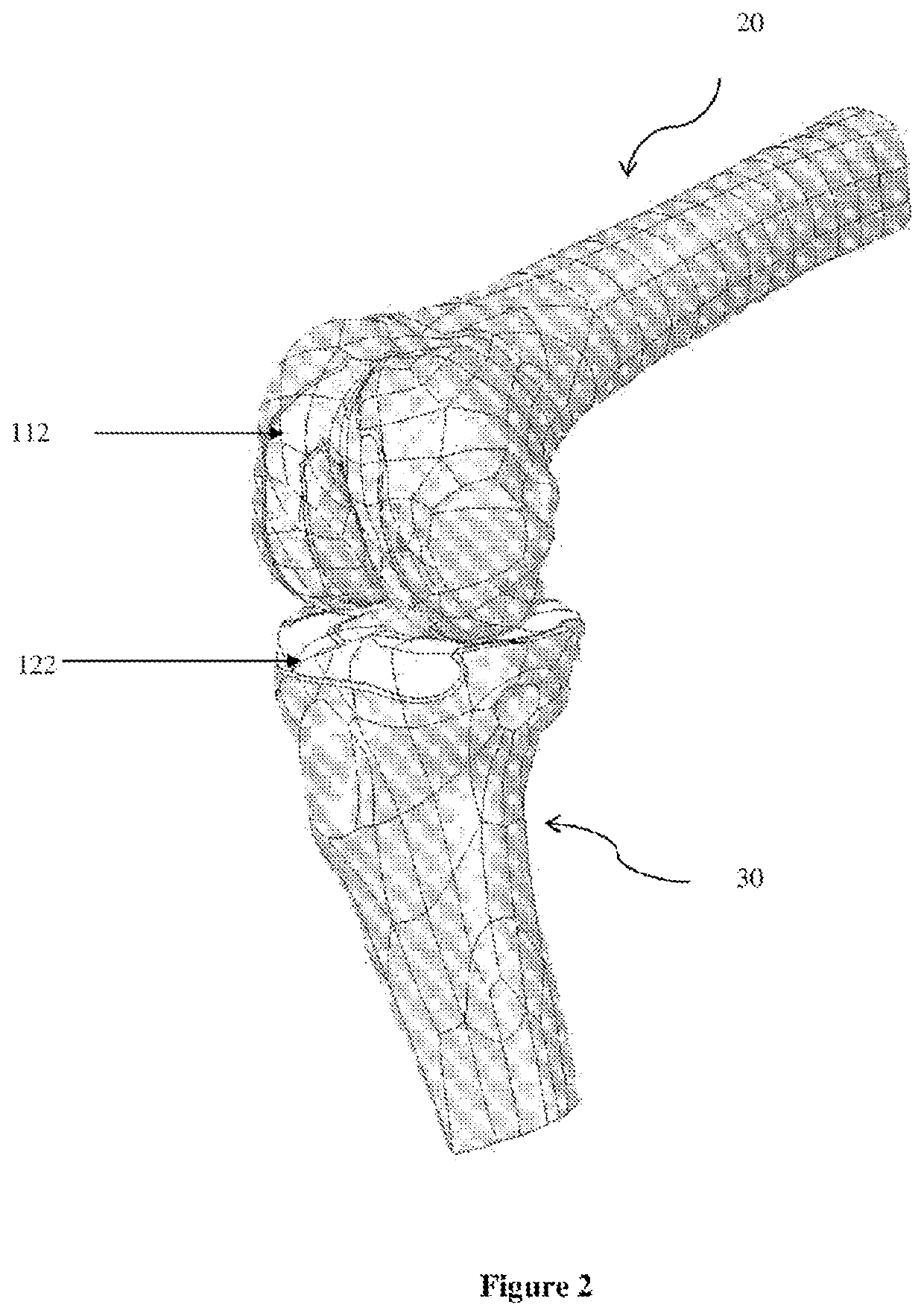 Method for producing a tailor-made implant