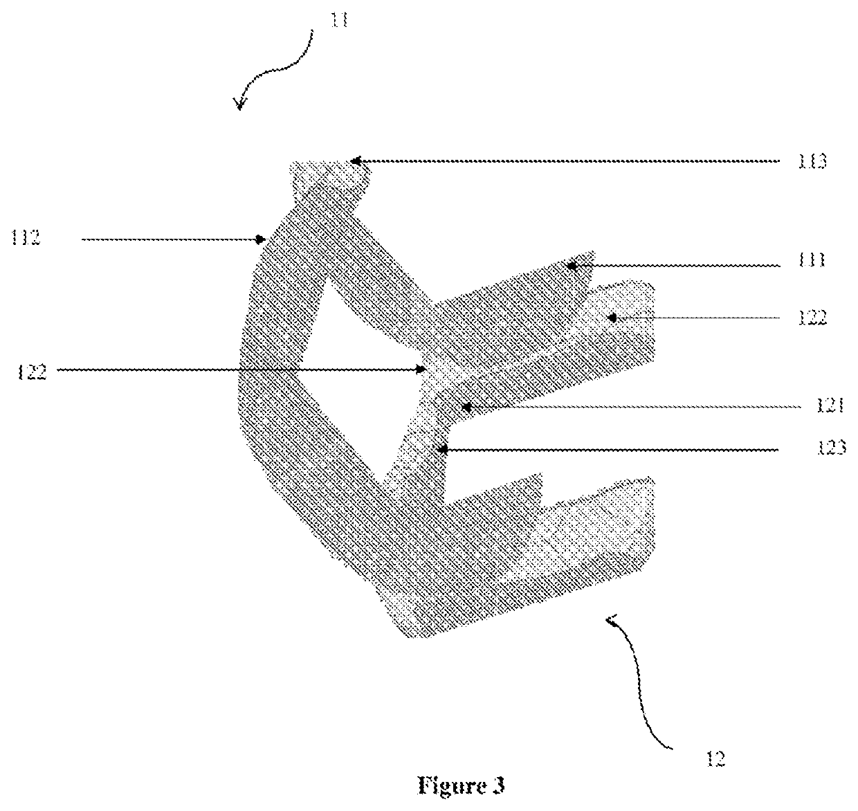 Method for producing a tailor-made implant