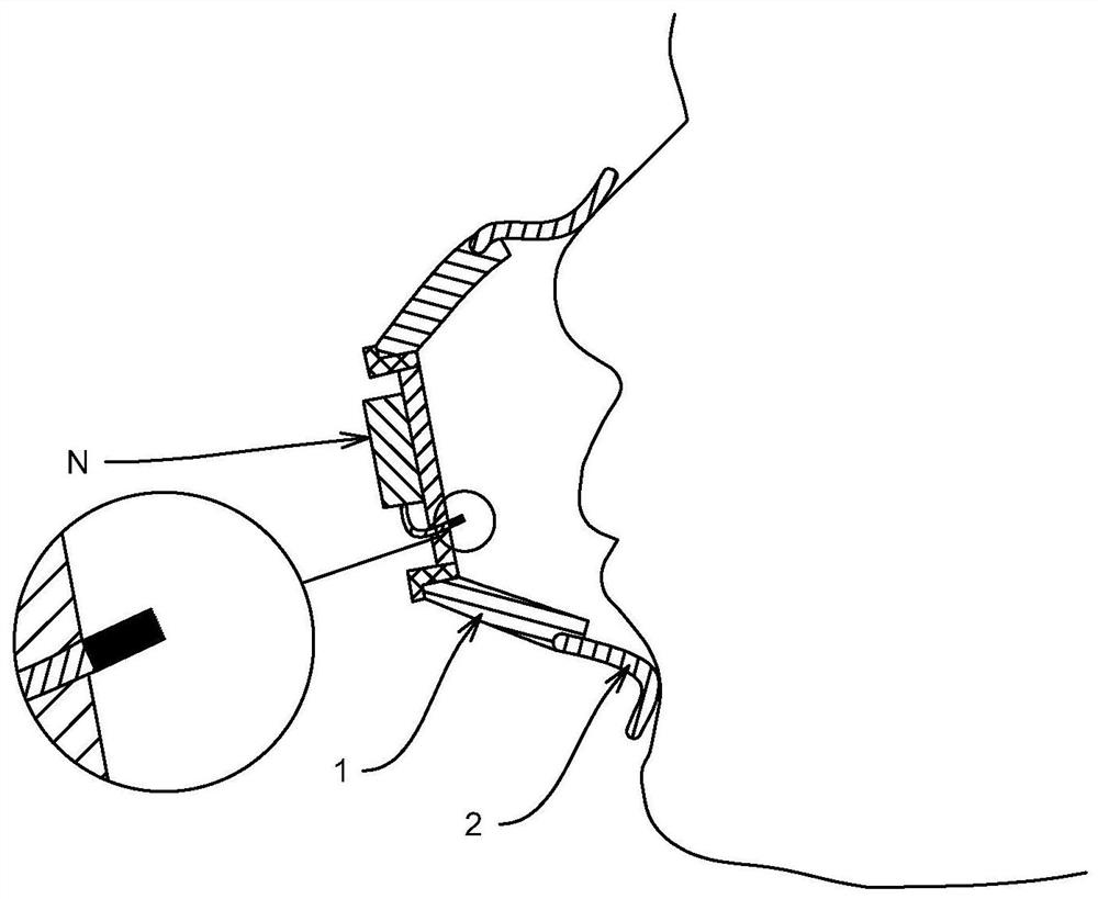 Wearable channel type negative ion device