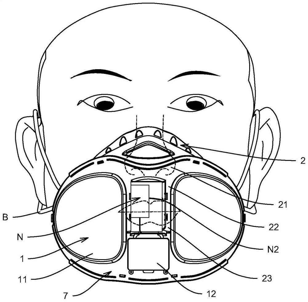 Wearable channel type negative ion device