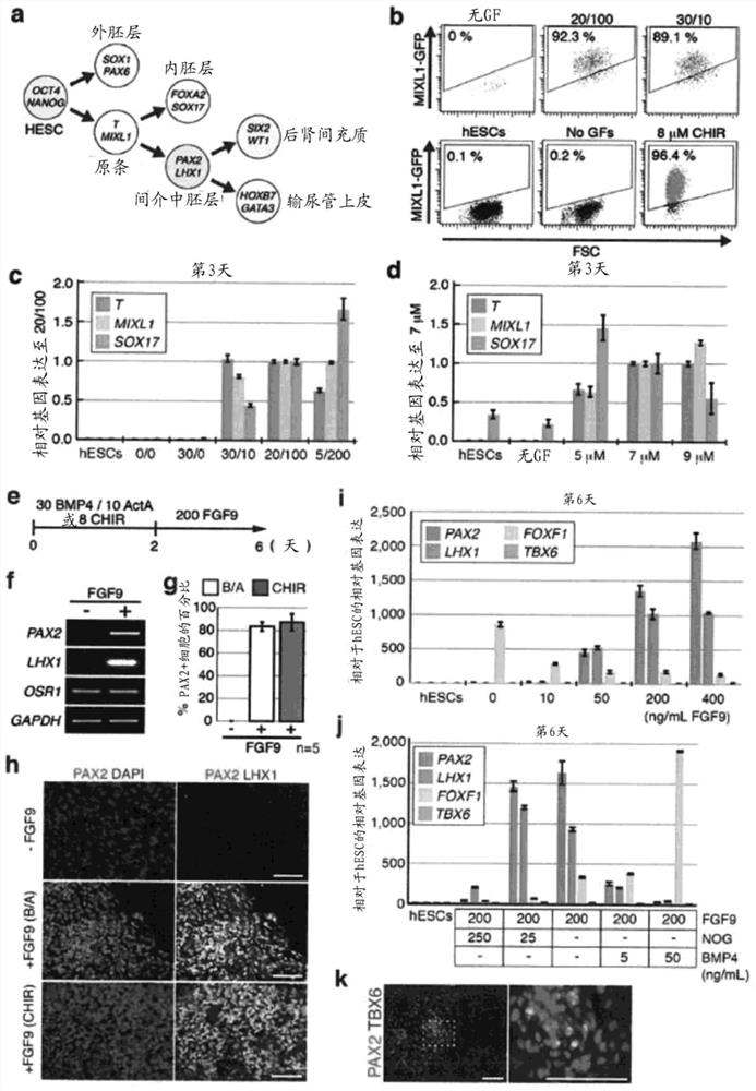 renal progenitor cells