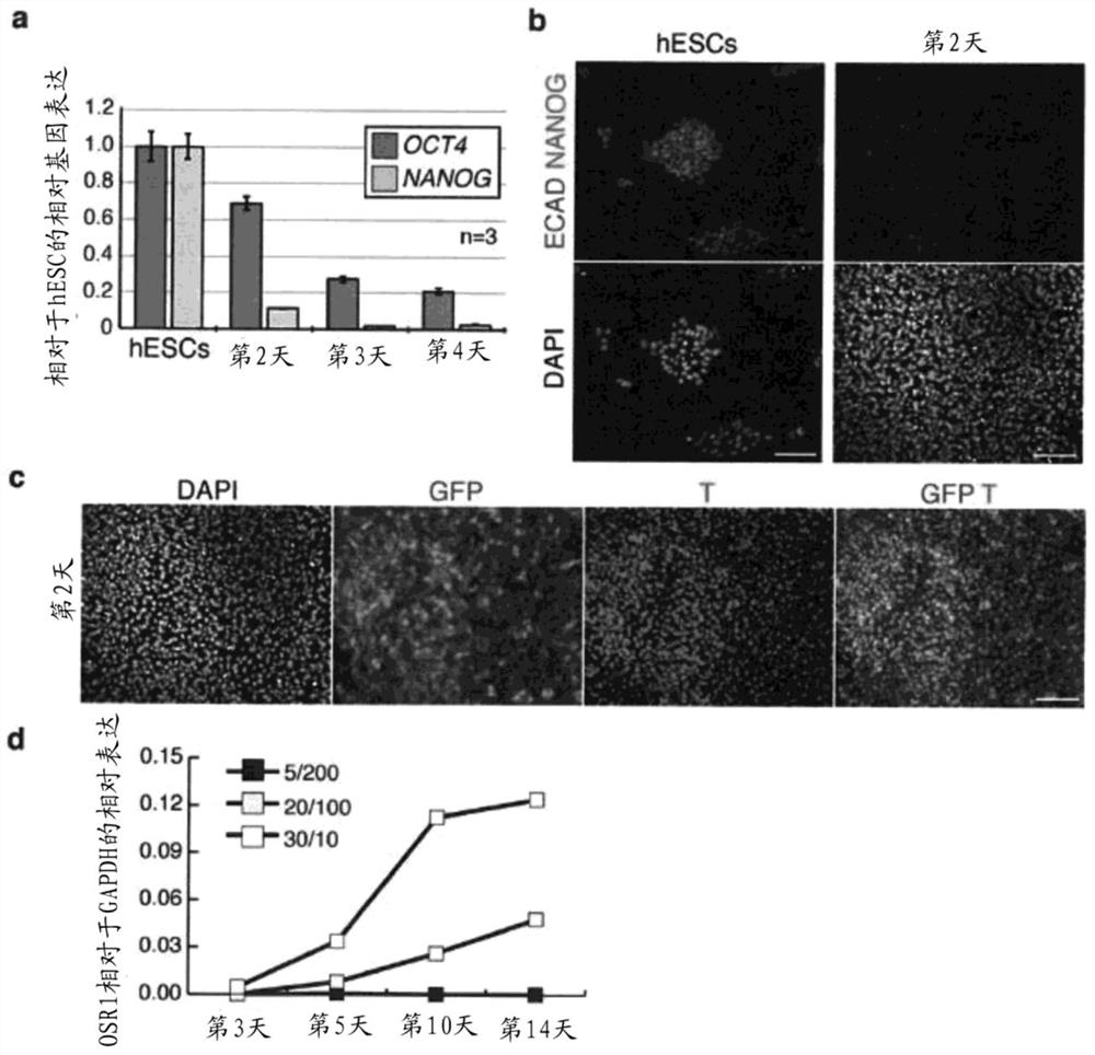 renal progenitor cells