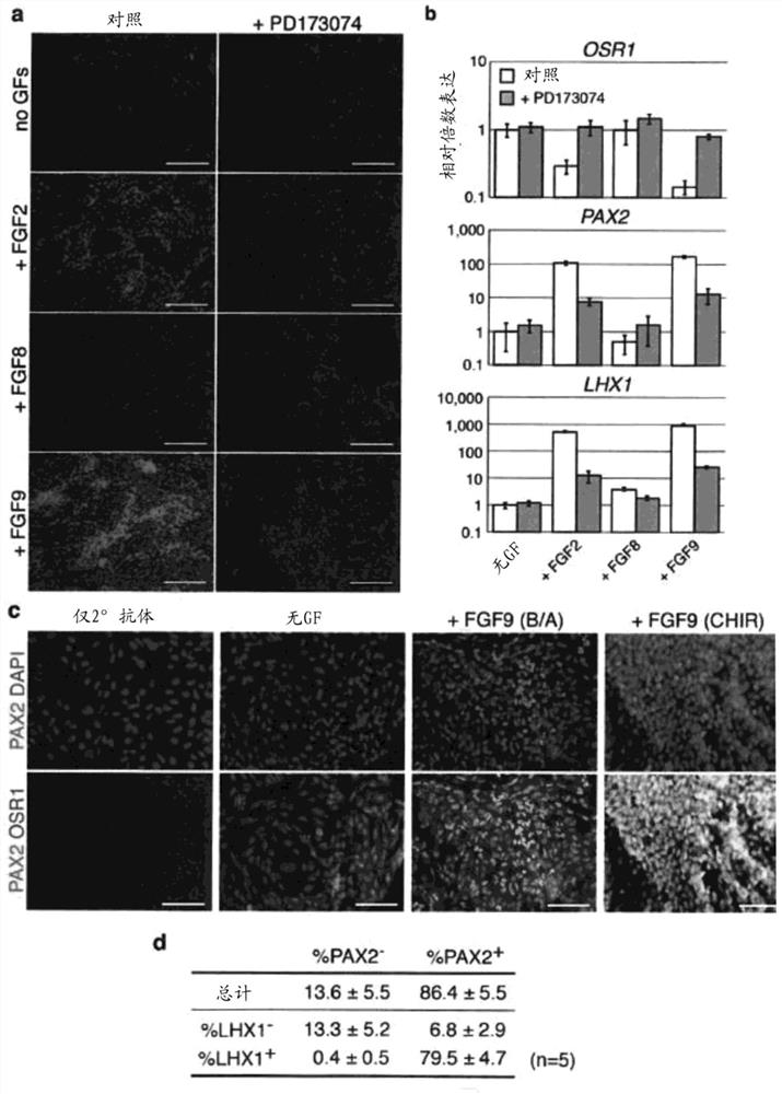 renal progenitor cells