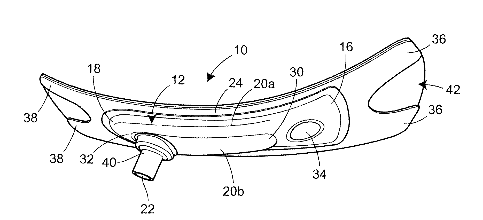 Urinary incontinence device and method