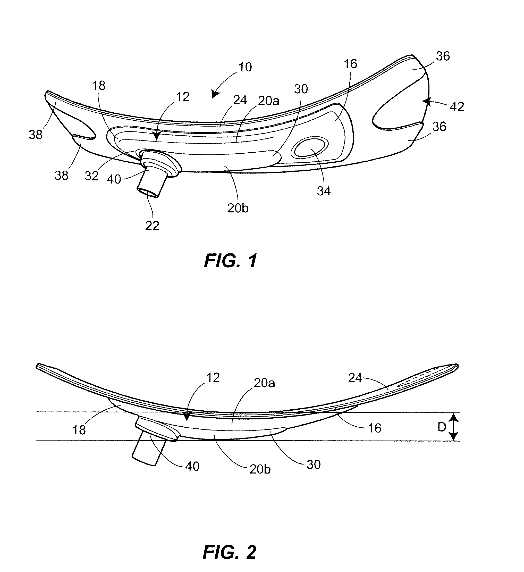 Urinary incontinence device and method