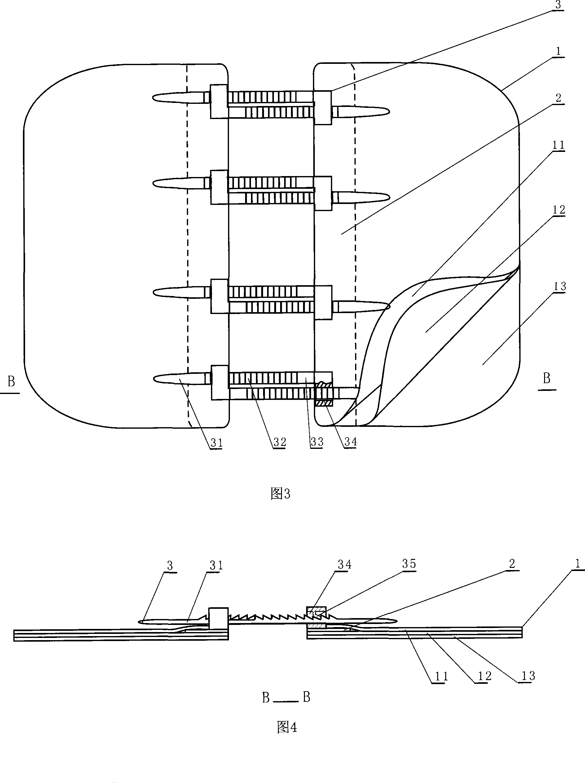 Skin wound stiching instrument and stiching method thereof